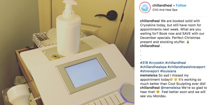 Fat Freezing with Cryoskin machine along with happy client Instagram Review